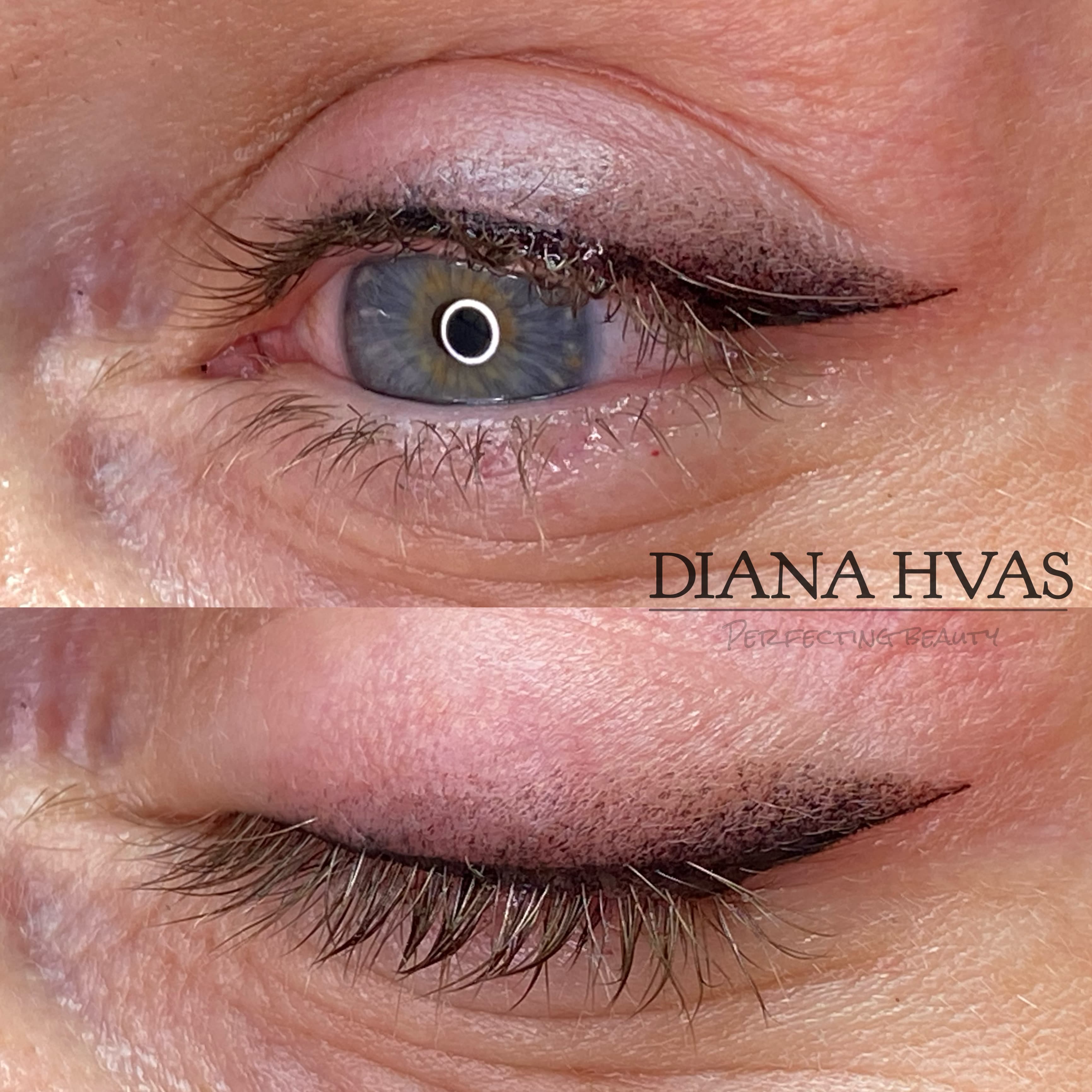 Permanent eyeliner før og efter resultat 2