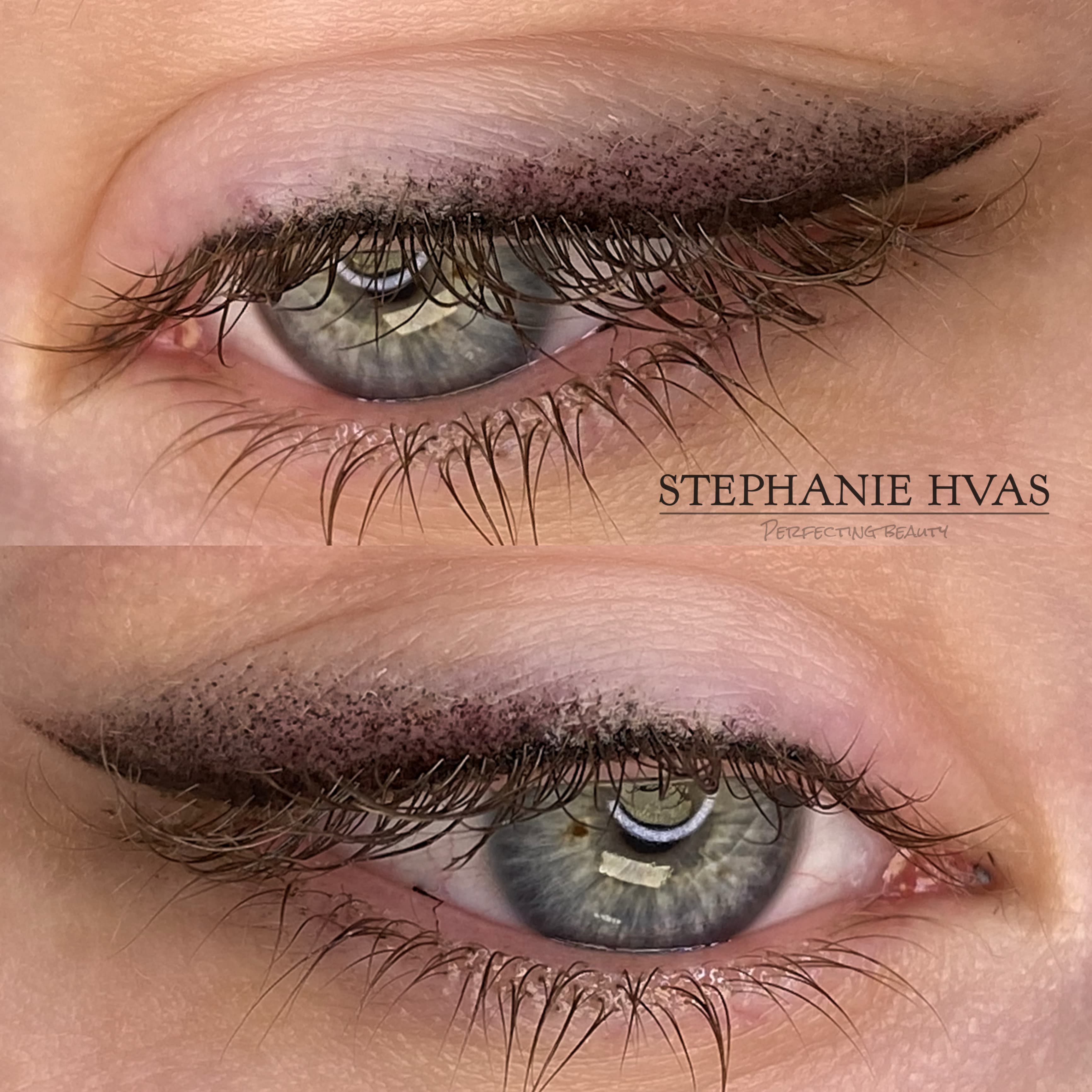 Permanent eyeliner før og efter resultat 4